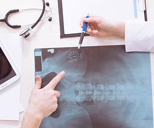 X-Ray Ergebnisse
